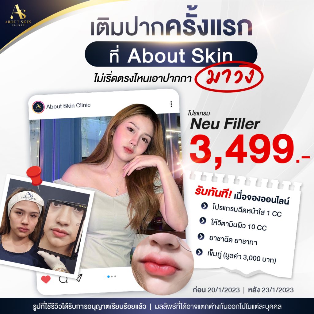 53_1 เพชร