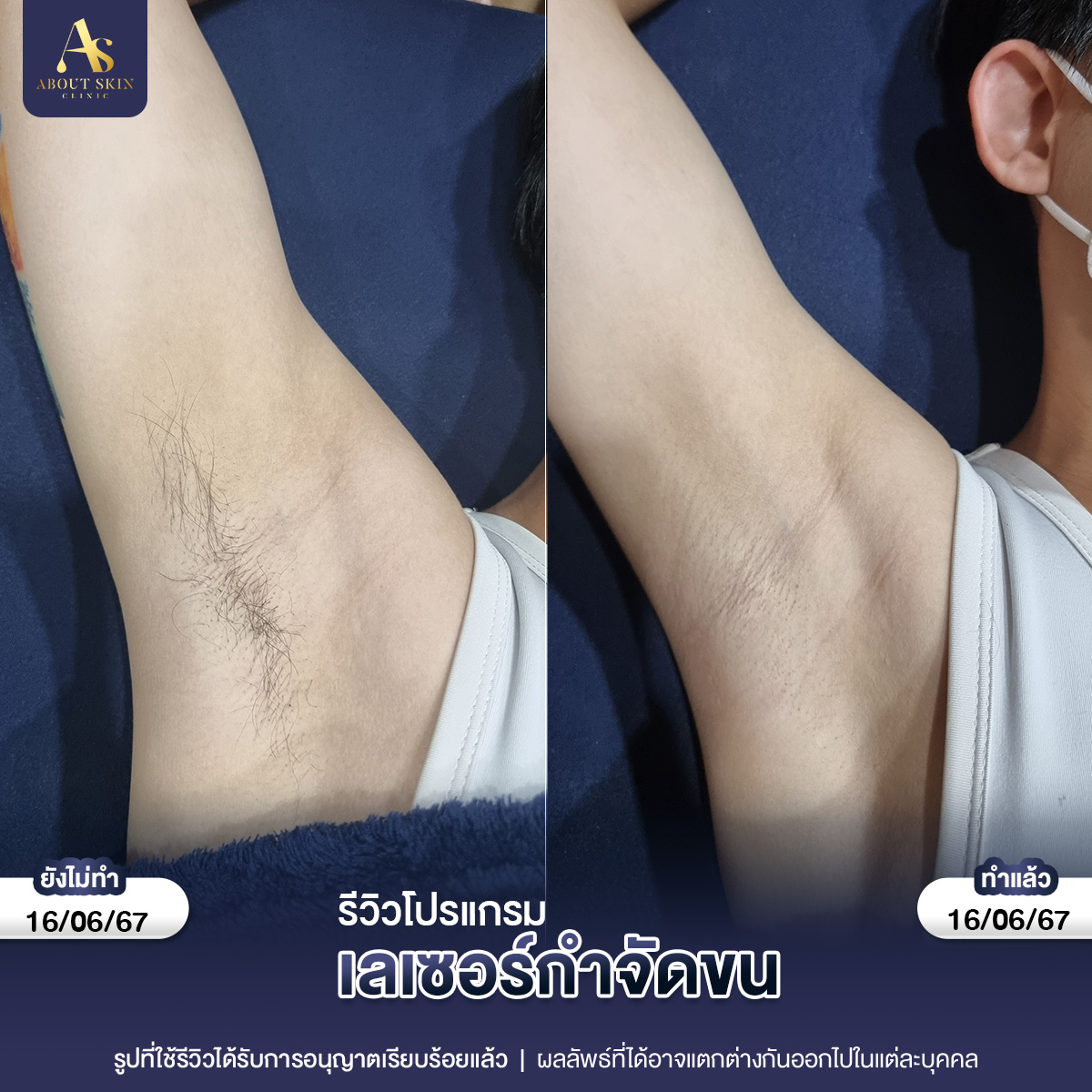 คุณกัน แฟตแก้ม 22_10_66 copy