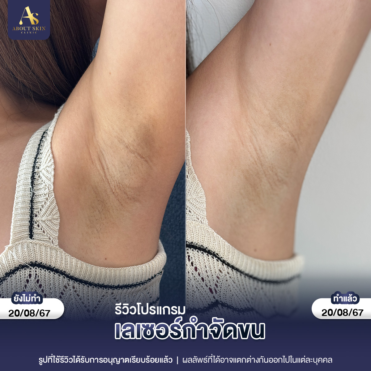 คุณกัน แฟตแก้ม 22_10_66 copy 2