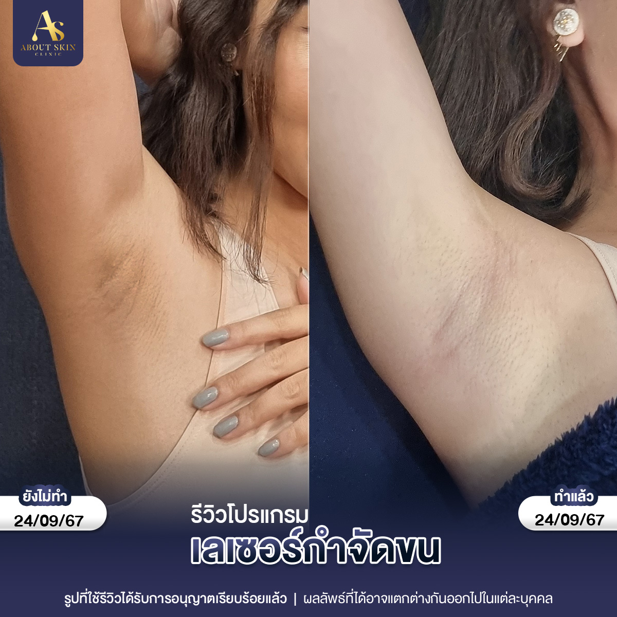 คุณกัน แฟตแก้ม 22_10_66 copy 3