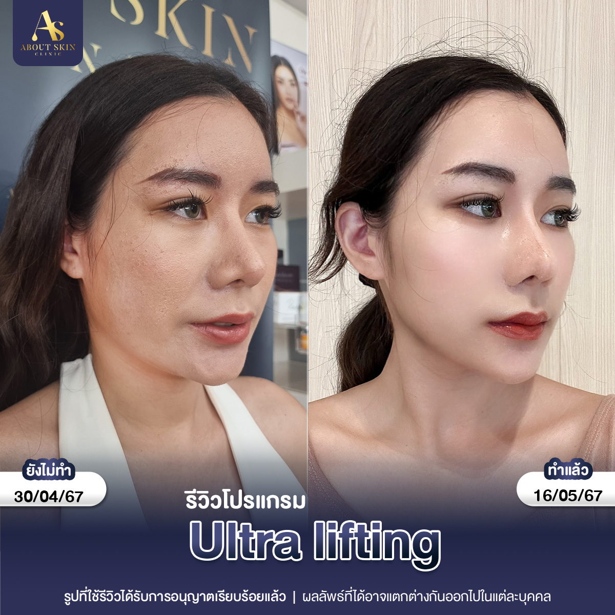 คุณมุ้ย