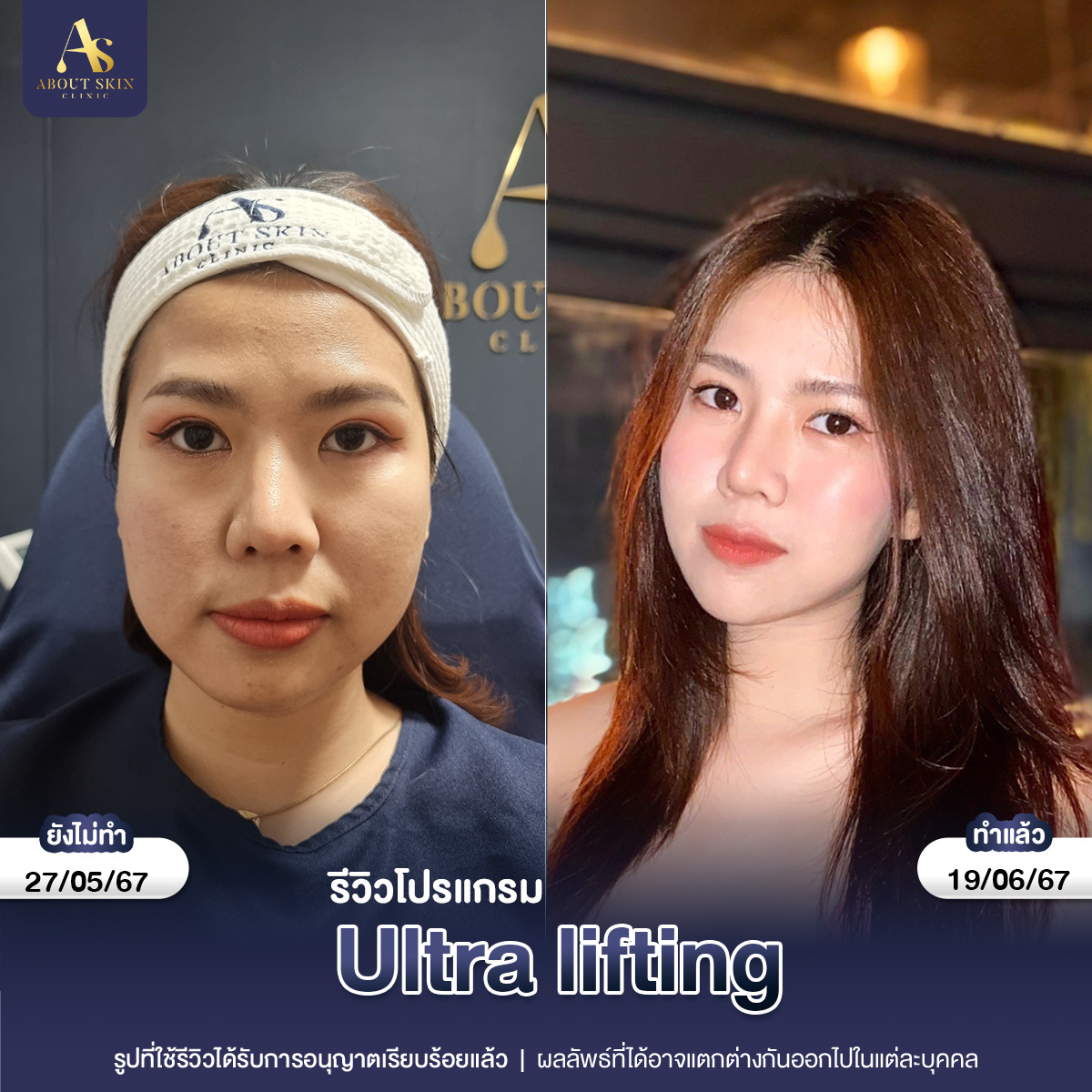 คุณองุ่น copy