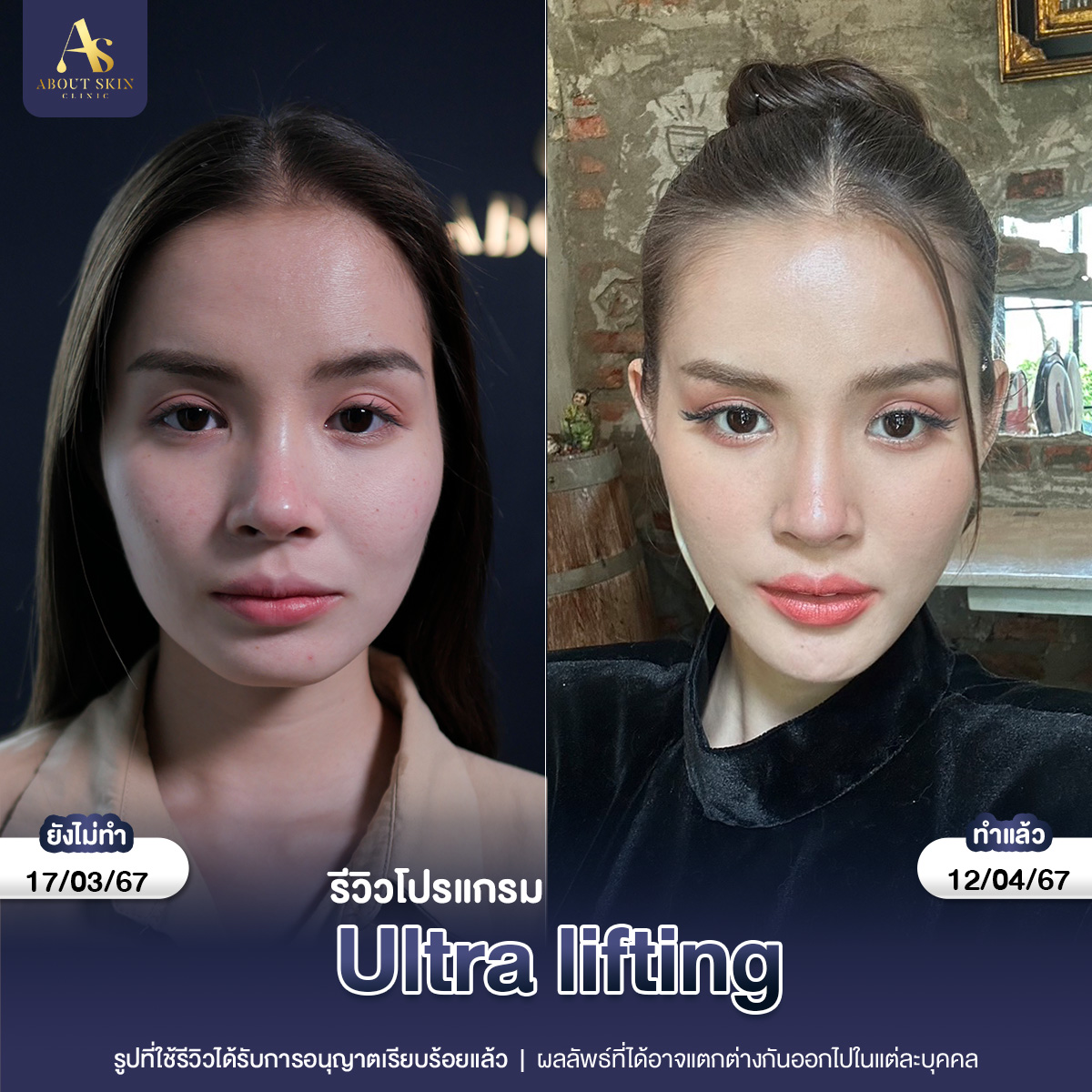 คุณเฟรน