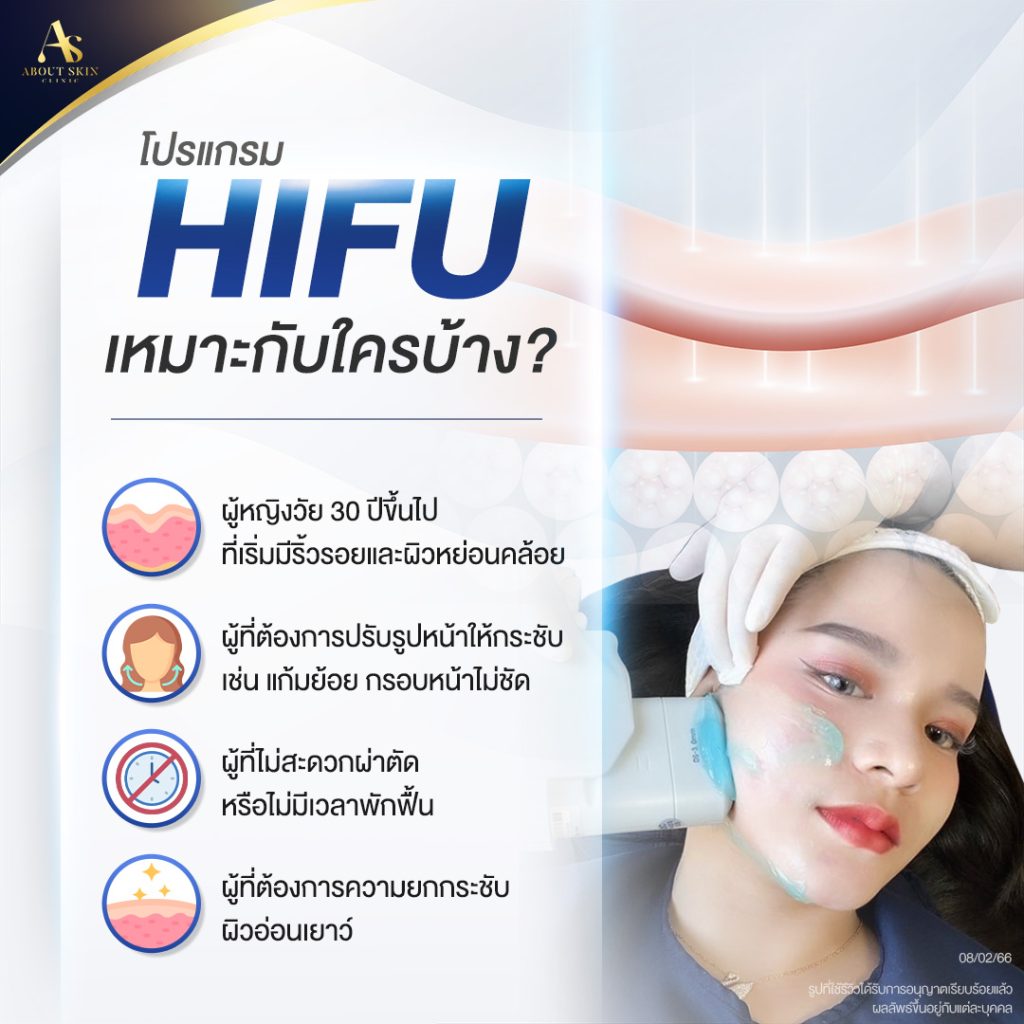 โปรแกรม HIFU เหมาะกับใครบ้าง