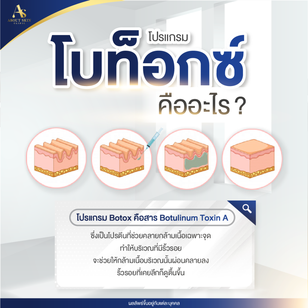 AB-June-3-1 โปรแกรมโบท็อกซ์คืออะไร
