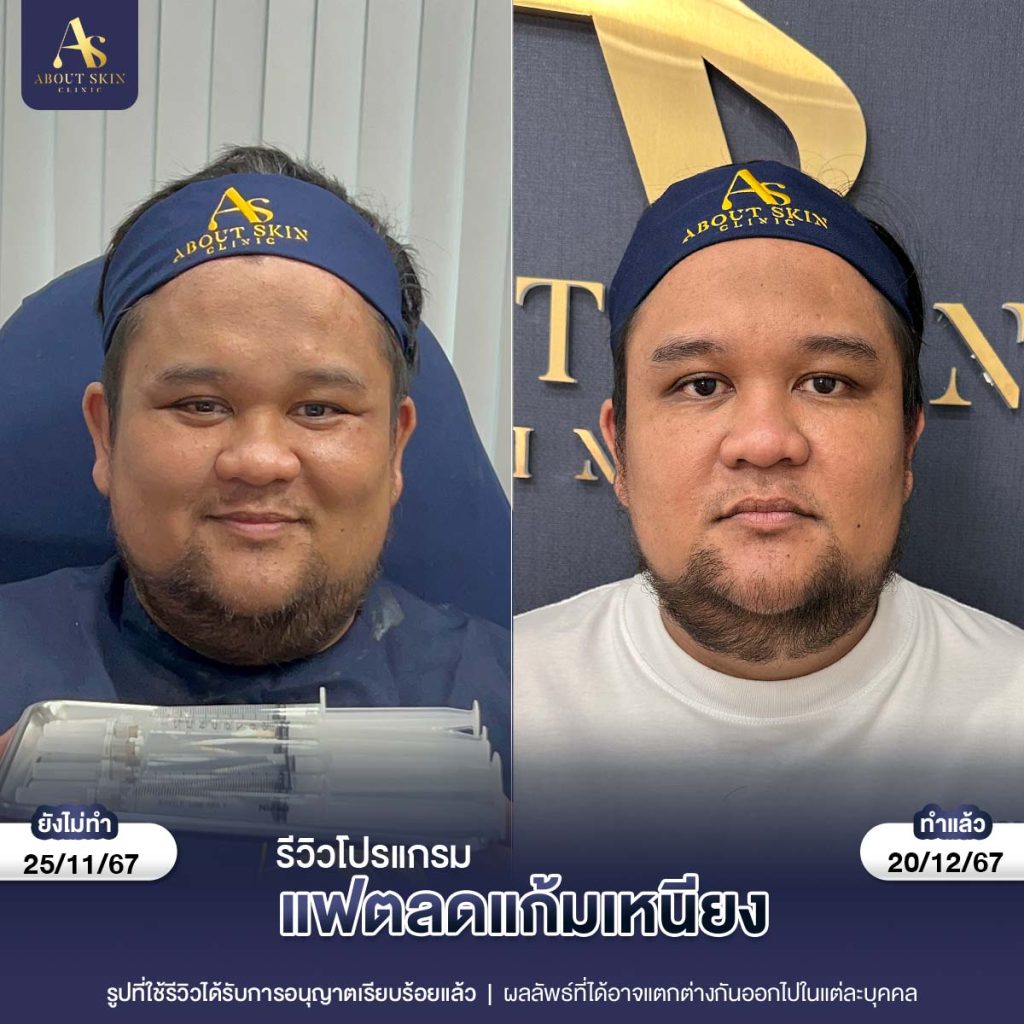 คุณบาร์จ 2