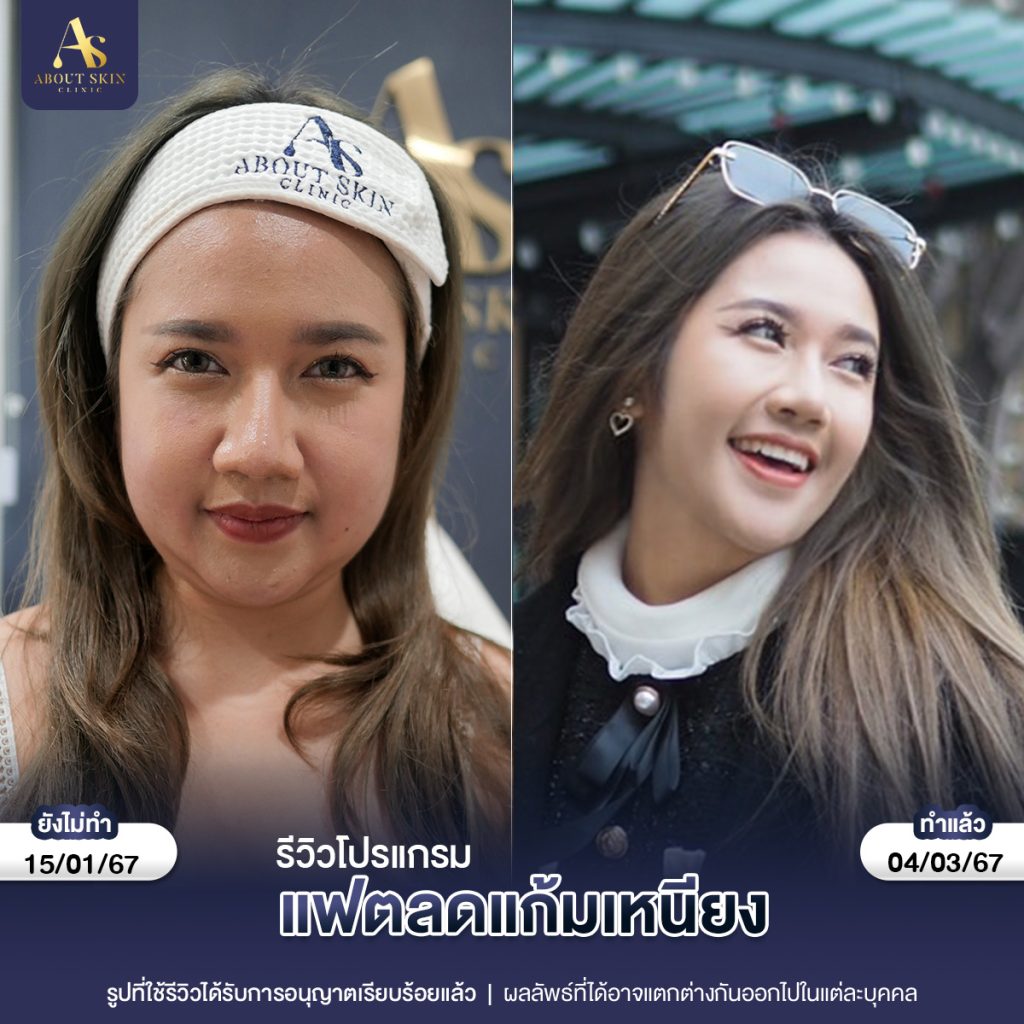 คุณพราว แฟตแก้มเหนียง 15_01_67