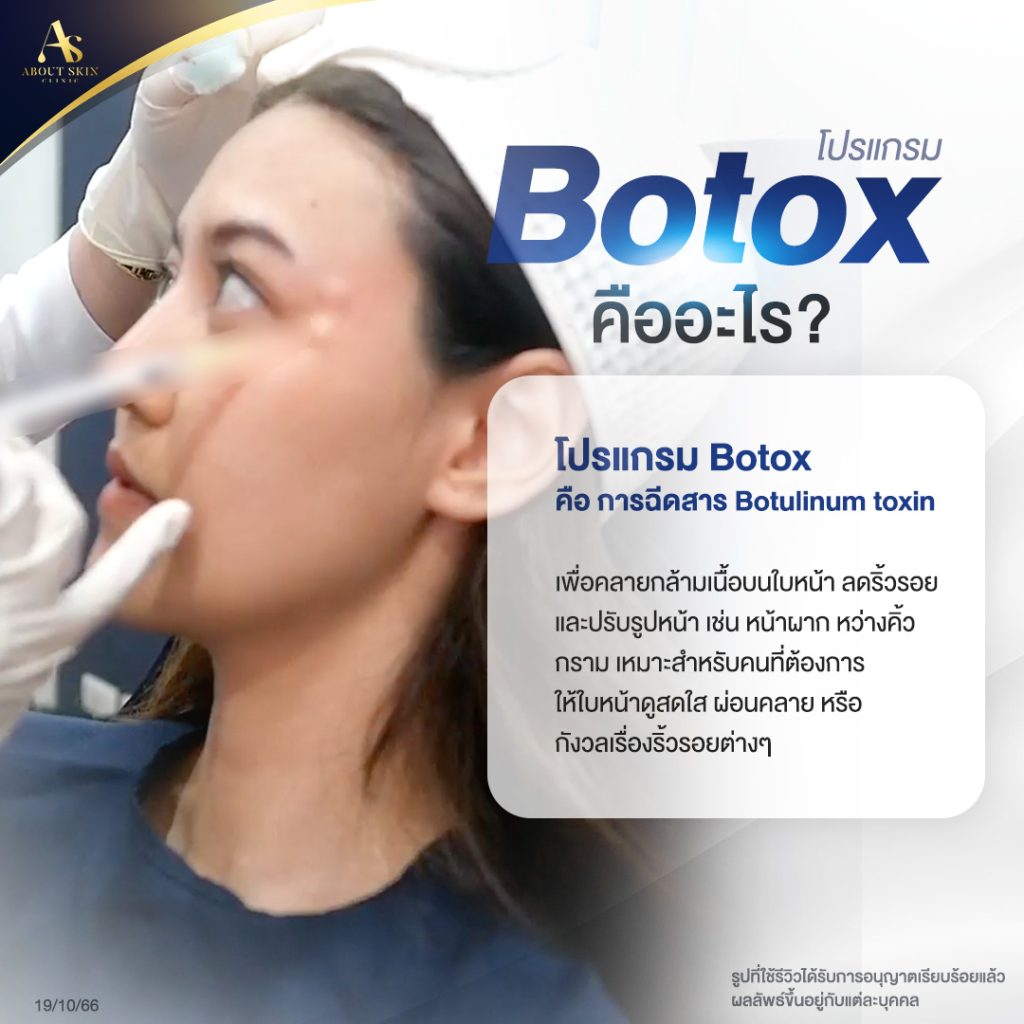 โปรแกรม Botox คืออะไร