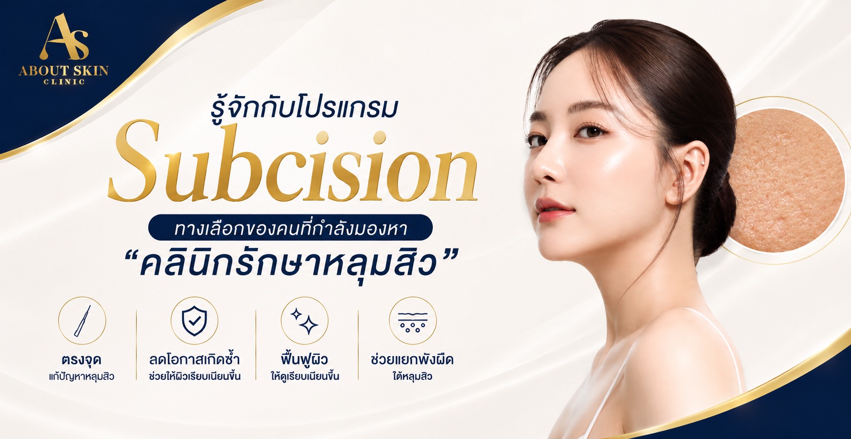 โปรแกรม Subcision คืออะไร