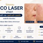 Pico Laser ดูแลฝ้า กระ จุดด่างดำ ที่ About Skin Clinic สาขาบางนา