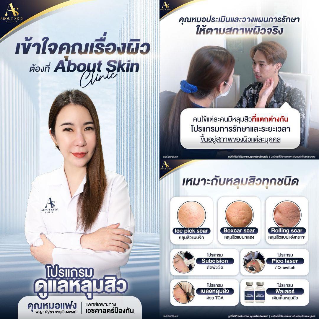 โปรแกรมดูแลหลุมสิว About Skin Clinic