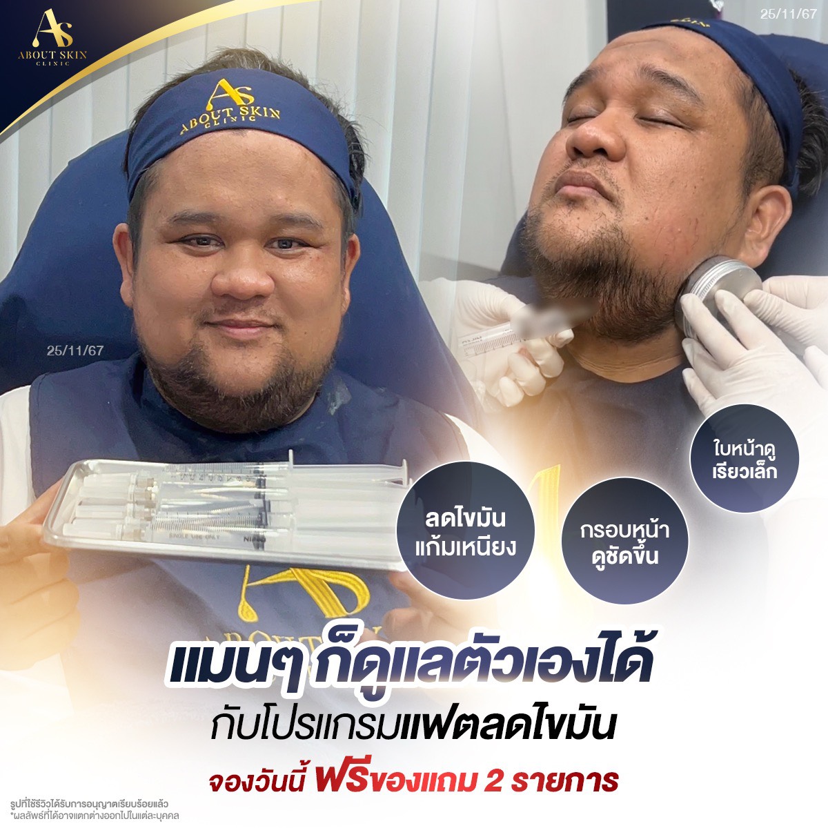 โปรแกรมแฟตลดไขมันสำหรับผู้ชาย About Skin Clinic