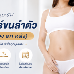 เลเซอร์ขนลำตัว About Skin Clinic