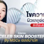 ภาพประกอบบทความ ไขความลับ เซลล์บำบัด MSCs ฟื้นบำรุงผิวให้แลดูอ่อนเยาว์ ลึกถึงระดับเซลล์ - About Skin Clinic