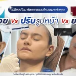 ภาพประกอบบทความ เปรียบเทียบวิธีดูแลผิว - ลดริ้วรอย ปรับรูปหน้า กระชับผิว แบบไหนที่เหมาะกับคุณ? - About Skin Clinic