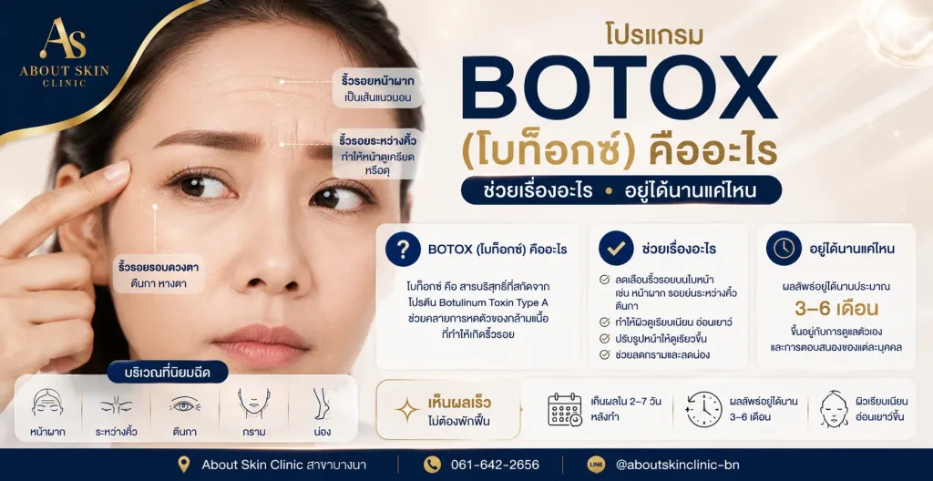 โบท็อกซ์ Botox ฉีดลดริ้วรอย