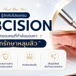 ภาพประกอบบทความ หลุมสิวรักษาได้จริงไหม? ทำความเข้าใจสาเหตุ พร้อมรู้จักโปรแกรม Subcision ทางเลือกของคนที่กำลังมองหา “คลินิกรักษาหลุมสิว” - About Skin Clinic