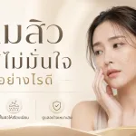 ภาพประกอบบทความ หลุมสิวทำให้ไม่มั่นใจ ทำอย่างไรดี - About Skin Clinic