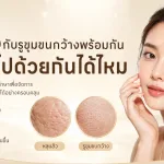 ภาพประกอบบทความ หลุมสิวกับรูขุมขนกว้างพร้อมกัน รักษาไปด้วยกันได้ไหม - About Skin Clinic