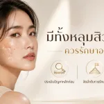 ภาพประกอบบทความ มีทั้งหลุมสิว ฝ้า กระ ควรรักษาอะไรก่อน - About Skin Clinic