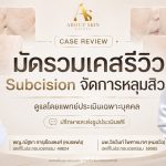 มัดรวมเคสรีวิว Subcision จัดการหลุมสิว About Skin Clinic