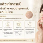 ภาพประกอบบทความ หลุมสิวเก่าหลายปี เพิ่งเริ่มรักษาตอนอายุมากแล้ว สายเกินไปไหม - About Skin Clinic