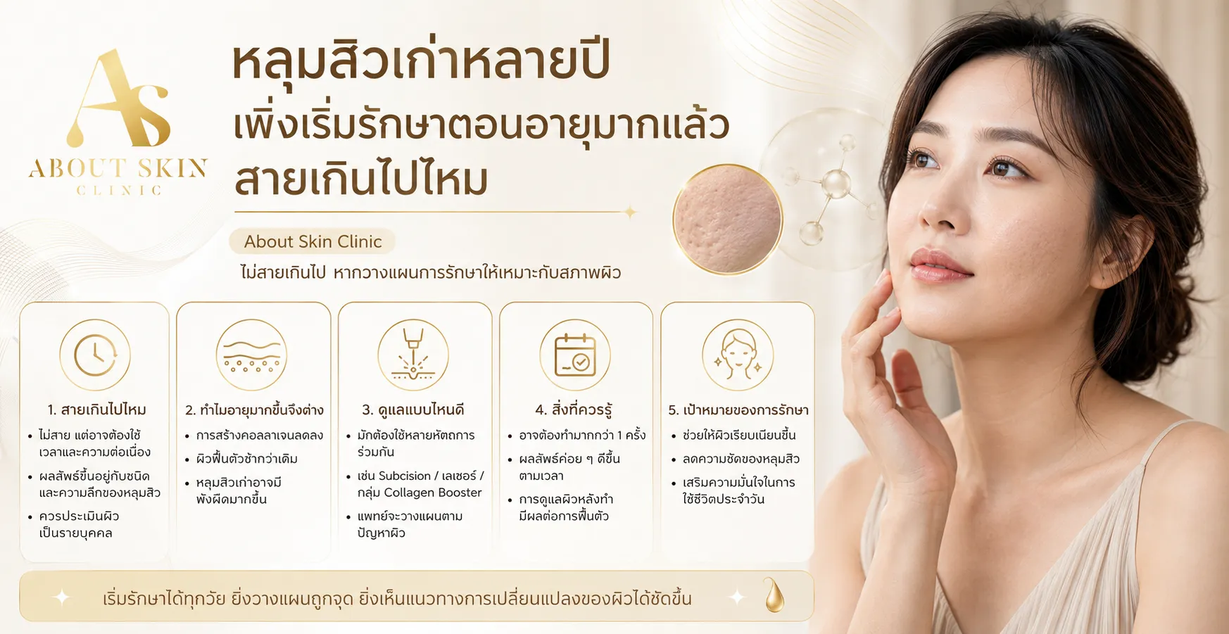 ภาพประกอบบทความ หลุมสิวเก่าหลายปี เพิ่งเริ่มรักษาตอนอายุมากแล้ว สายเกินไปไหม - About Skin Clinic