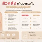 ภาพประกอบบทความ สิวหลัง เกิดจากอะไร ดูแลต่างจากสิวหน้าอย่างไร - About Skin Clinic