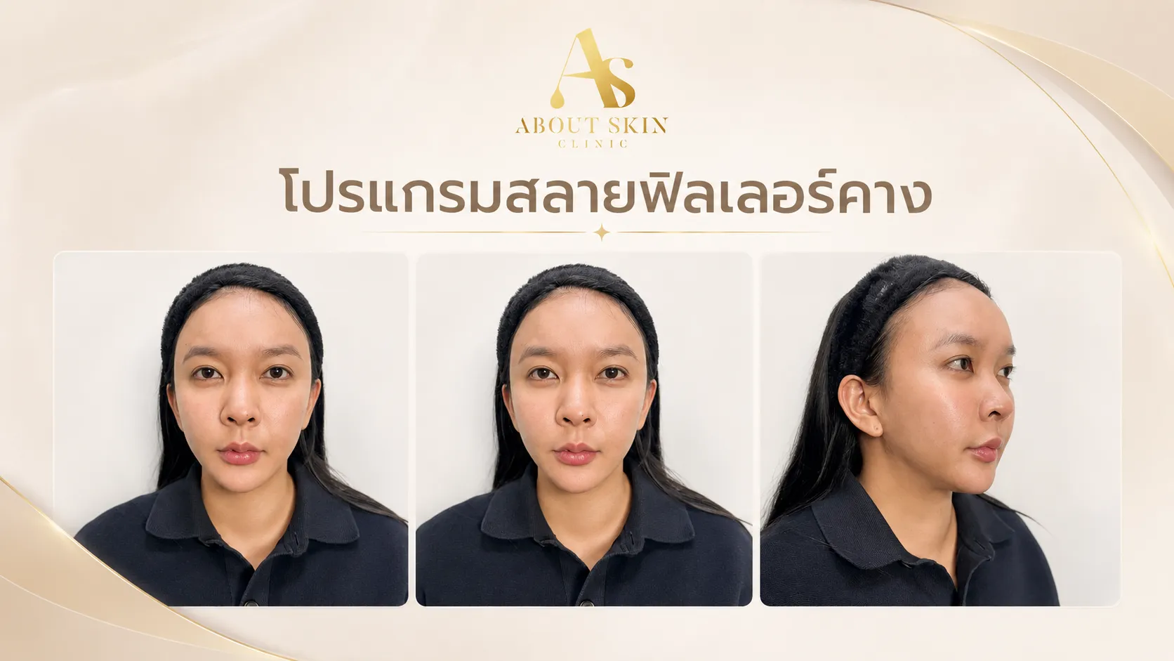 โปรแกรมสลายฟิลเลอร์คาง คำถามที่พบบ่อย | About Skin Clinic