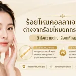 ภาพประกอบบทความ ร้อยไหมคอลลาเจน คืออะไร ต่างจากร้อยไหมยกกระชับอย่างไร - About Skin Clinic
