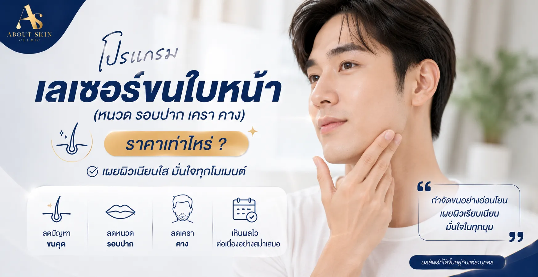 เลเซอร์หนวด About Skin Clinic Diode laser ไดโอดเลเซอร์