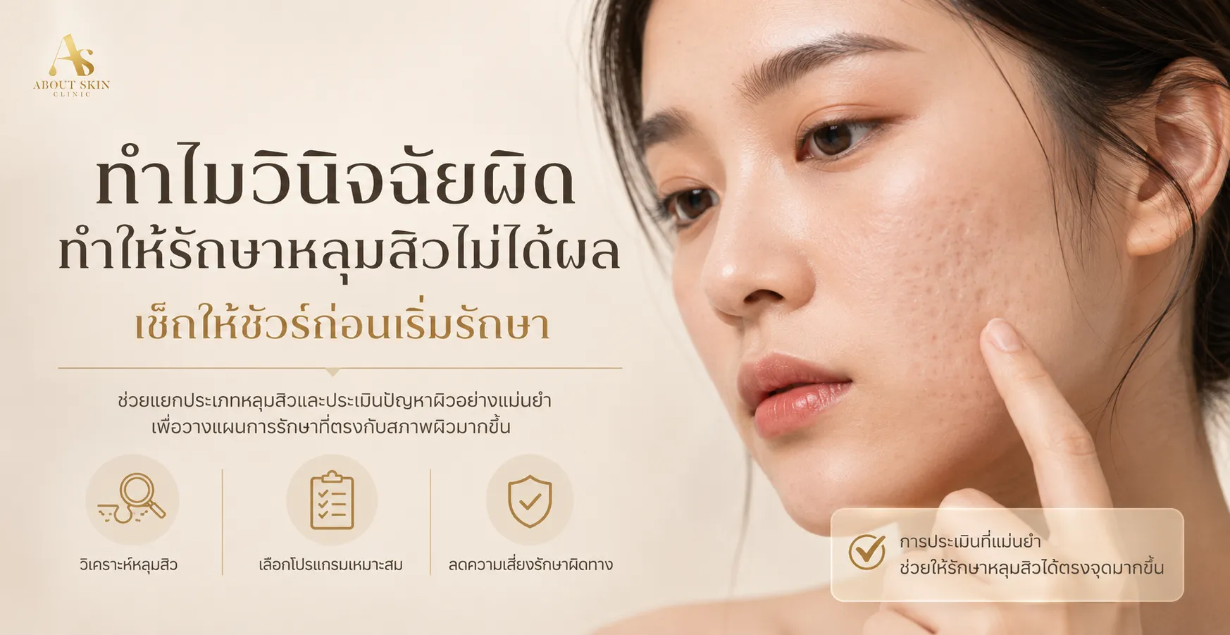 ภาพประกอบบทความ ทำไมวินิจฉัยผิดทำให้รักษาหลุมสิวไม่ได้ผล เช็คให้ชัวร์ก่อนเริ่มรักษา - About Skin Clinic