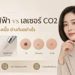 ภาพประกอบบทความ ข้อดี-ข้อเสีย เครื่องจี้ไฟฟ้า vs เลเซอร์ CO2 จี้ขี้แมลงวัน ไฝ ติ่งเนื้อ - About Skin Clinic
