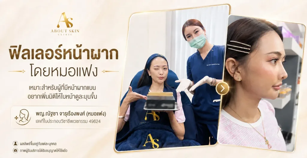 รีวิวเคสฟิลเลอร์หน้าผาก หมอแฟง About Skin Clinic