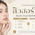 ภาพประกอบบทความ สิวฮอร์โมน คืออะไร ต่างจากสิวทั่วไปอย่างไร - About Skin Clinic