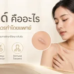 ภาพประกอบบทความ คีลอยด์ คืออะไร โปรแกรมฉีดต้องทำโดยแพทย์เท่านั้น - About Skin Clinic