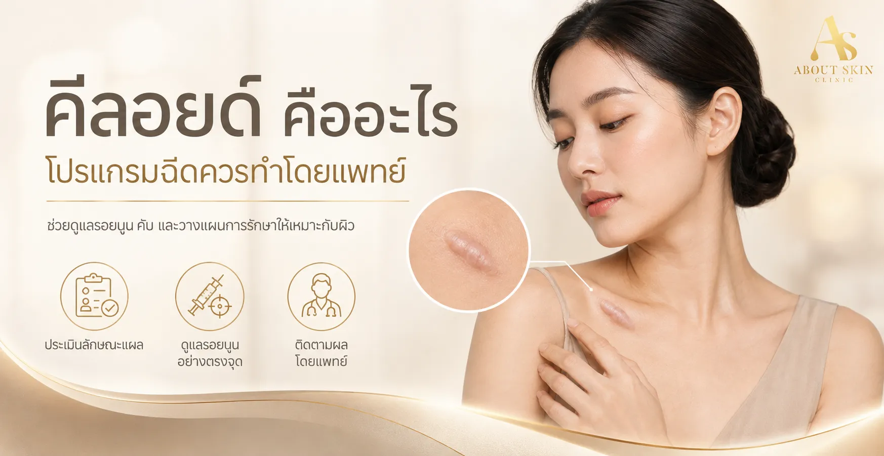ภาพประกอบบทความ คีลอยด์ คืออะไร โปรแกรมฉีดต้องทำโดยแพทย์เท่านั้น - About Skin Clinic