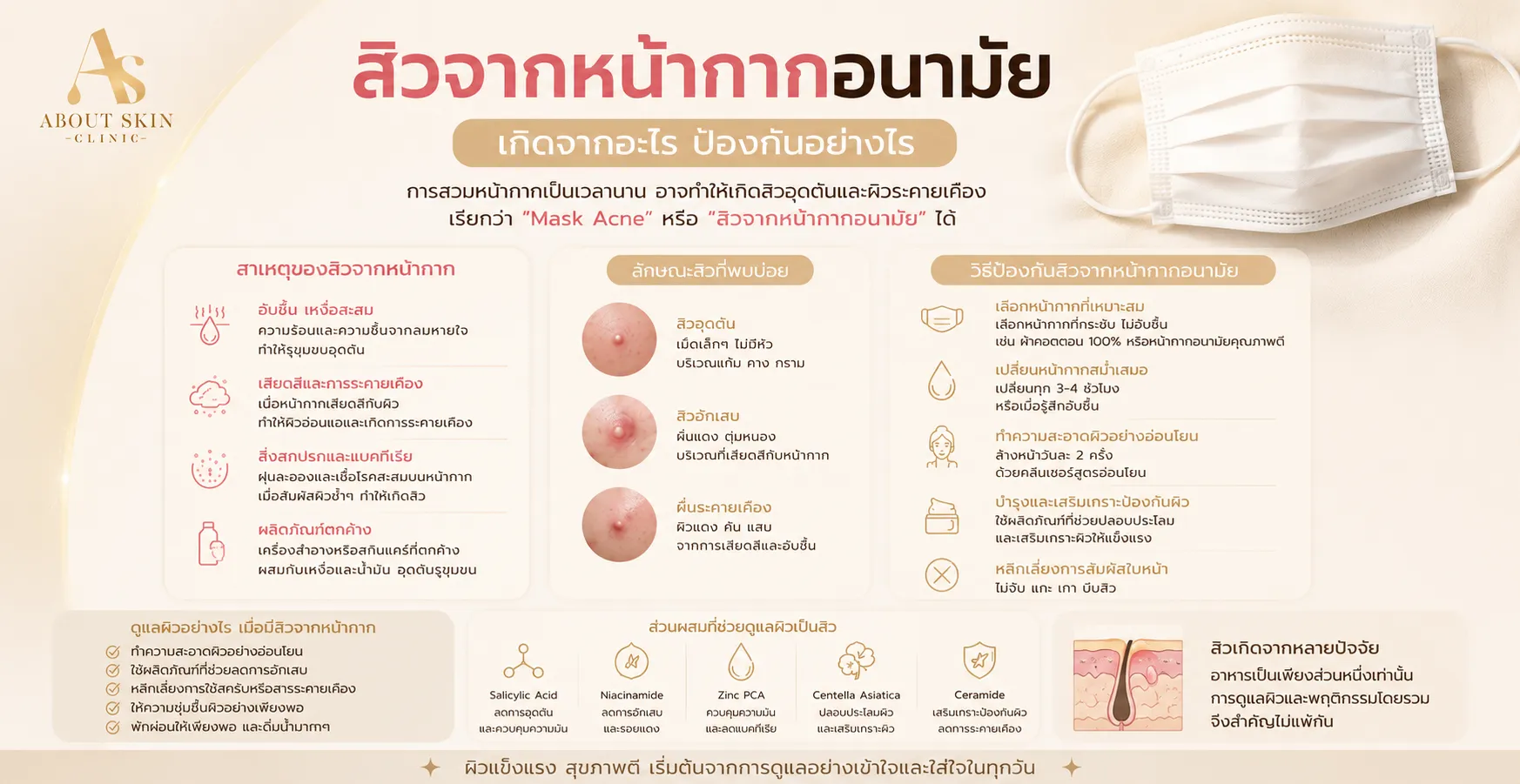 ภาพประกอบบทความ Maskne สิวจากหน้ากากอนามัย เกิดจากอะไร ป้องกันอย่างไร - About Skin Clinic