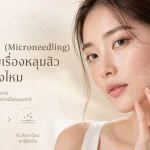 ภาพประกอบบทความ ไมโครนีดลิ่ง (Microneedling) คืออะไร ช่วยเรื่องหลุมสิว รูขุมขนได้จริงไหม - About Skin Clinic