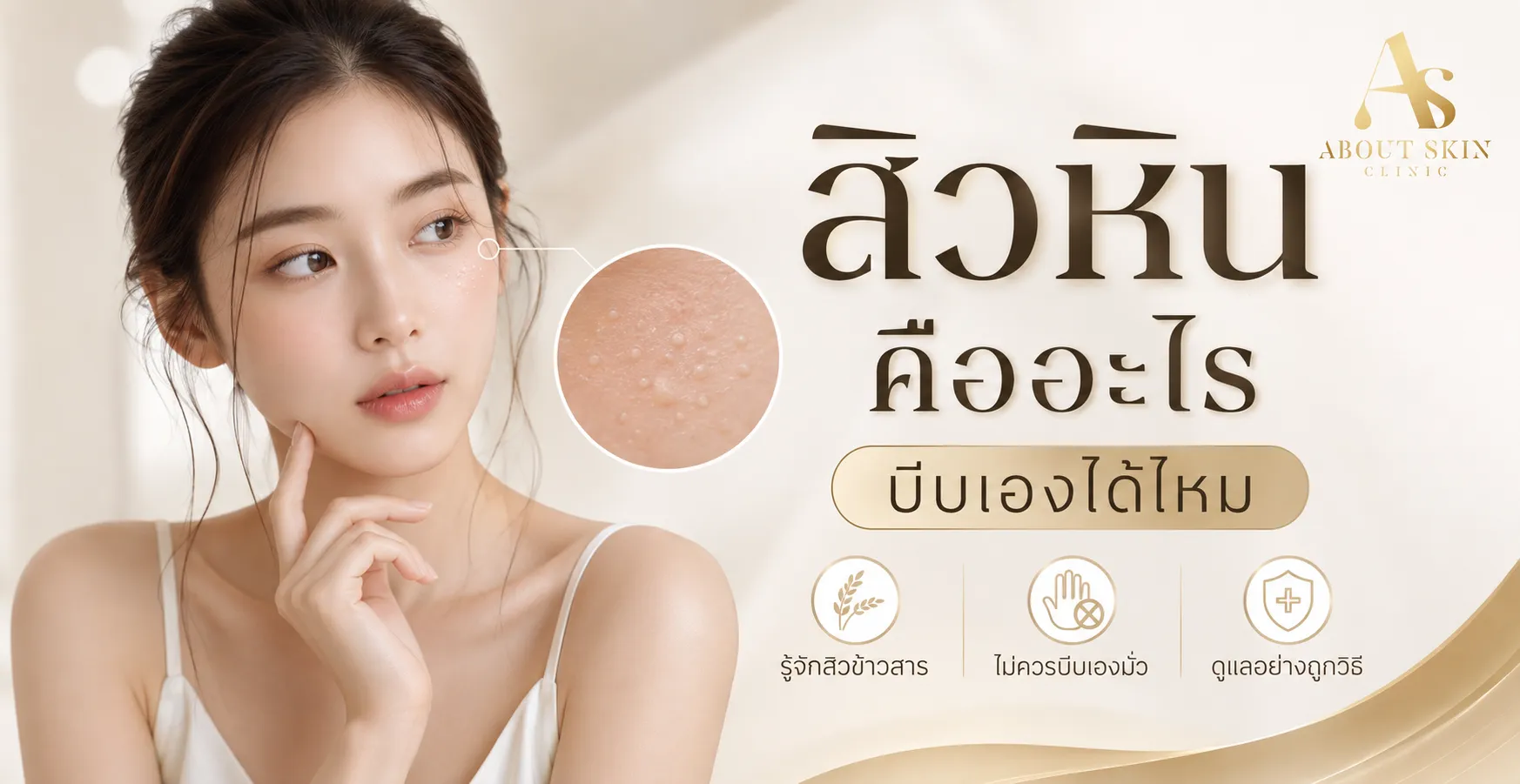 ภาพประกอบบทความ สิวหิน (สิวข้าวสาร) คืออะไร บีบเองได้ไหม - About Skin Clinic