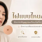 ภาพประกอบบทความ ไฝมะเร็ง สังเกตยังไง ไฝแบบไหนควรให้แพทย์ตรวจ - About Skin Clinic