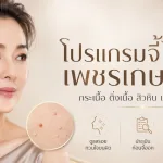 ภาพประกอบบทความ โปรแกรมจี้ไฝ เพชรเกษม 81 โปรแกรมจี้กระเนื้อ โปรแกรมติ่งเนื้อ โปรแกรมสิวหิน โปรแกรมต่อมไขมัน - About Skin Clinic