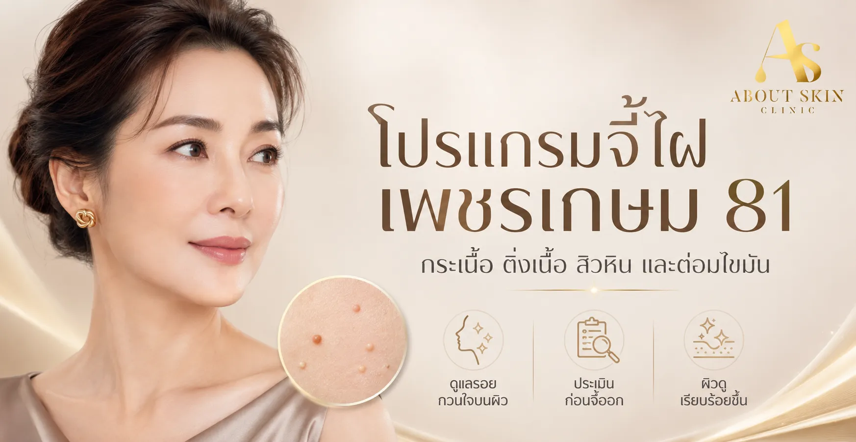 ภาพประกอบบทความ โปรแกรมจี้ไฝ เพชรเกษม 81 โปรแกรมจี้กระเนื้อ โปรแกรมติ่งเนื้อ โปรแกรมสิวหิน โปรแกรมต่อมไขมัน - About Skin Clinic