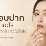 ภาพประกอบบทความ สิวรอบปาก เกิดจากอะไร ดูแลต่างจากสิวทั่วไปยังไง - About Skin Clinic