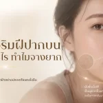 ภาพประกอบบทความ ฝ้าเหนือริมฝีปากบน เกิดจากอะไร ทำไมจางยาก - About Skin Clinic