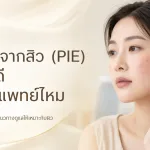 ภาพประกอบบทความ รอยแดงจากสิว (PIE) ทาอะไรดี ต้องพบแพทย์ไหม - About Skin Clinic