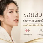 ภาพประกอบบทความ รอยสิว คืออะไร ต่างจากหลุมสิวอย่างไร ทาครีมพอไหม - About Skin Clinic