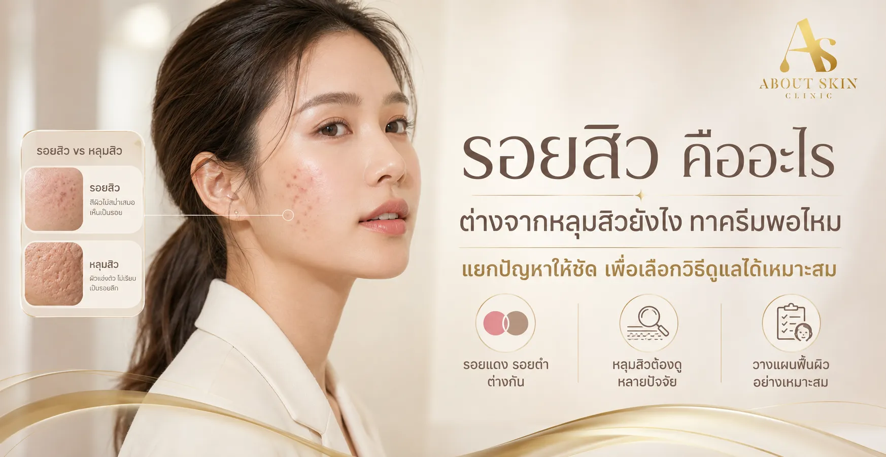 ภาพประกอบบทความ รอยสิว คืออะไร ต่างจากหลุมสิวอย่างไร ทาครีมพอไหม - About Skin Clinic