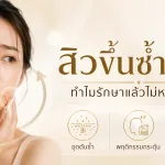 ภาพประกอบบทความ สิวขึ้นซ้ำที่เดิม ทำไมรักษาแล้วไม่หายสักที - About Skin Clinic
