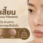 ภาพประกอบบทความ สิวเสี้ยน (Sebaceous Filament) คืออะไร ต่างจากสิวหัวดำและหลุมสิวยังไง - About Skin Clinic